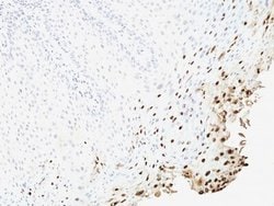HPV16 Antibody (SPM257) - Azide and BSA Free, Novus Biologicals 100 &mu;g;